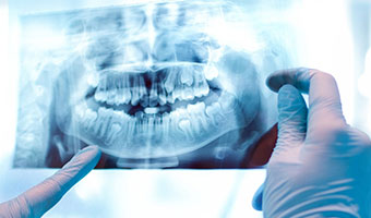 doctorpaya oral radiology