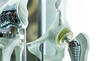 doctorpaya orthoses prostheses | تخصص | دکتر پایا